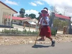 Kapolda NTT Bantu Kaki Palsu Siswa SD Tuapanaf