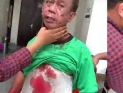 Bom Bunuh Diri di katedral Makassar, Ini Korbannya. 