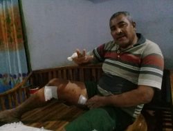 Warga Kota Kupang Diserang Buaya, Dua jari Putus, Namun Selamat