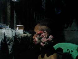Tega Nian, Rumah Sakit WZ. Johanes Pulangkan Pasien Kanker