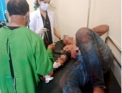 Miras Bikin Gelap Mata, Anggota Polsek Amarasi, Dibacok Kawan Akrab
