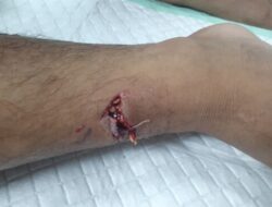 Pemerintah Gerak Cepat Investigasi Kasus Gigitan Anjing di Bello